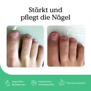 Maxi-Set „Nagelpilz-Kur“